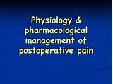 Pharmacological Pain Management Photos