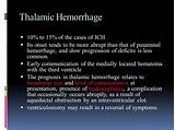 Thalamic Stroke Treatment Images