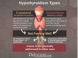 What Is The Best Medication For Hypothyroidism Pictures