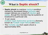 What Is The Medical Condition Sepsis Pictures