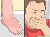 Images of What Kind Of Doctor Would You See For Gout