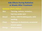 Photos of Lung Radiation Treatment Side Effects