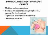 Photos of What Is The Treatment For Breast Cancer