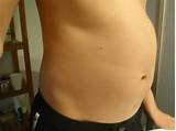 Bloated Belly And Gas Symptoms