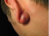 Images of Ear Pain Doctor Near Me