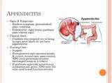 Images of Is Gas A Symptom Of Appendicitis