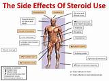 Pictures of Steroid Pack Side Effects