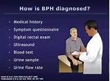 Pictures of Bph Medical Term
