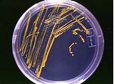 Photos of Culture Plates Microbiology