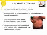 Gallstones Diagnosis And Treatment Photos