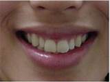 Images of Direct Dental Pico Rivera