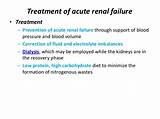 Pictures of Acute Renal Failure Treatment