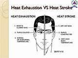 Images of Heat Exhaustion Heat Stroke Treatment