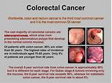 Colorectal Cancer Treatment Options