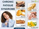 What Is The Treatment For Chronic Fatigue Syndrome