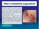 Accutane Treatment For Hidradenitis Suppurativa Photos