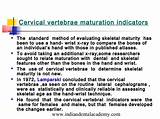 Skeletal Maturity Indicators In Orthodontics Photos