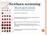 Images of Newborn Screening Market