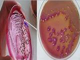Pictures of Antibiotic Treatment For Klebsiella Pneumoniae Uti
