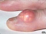 Pictures of What Type Of Doctor Should I See For Gout