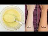 Skin Whitening Home Remedies In 10 Days Images