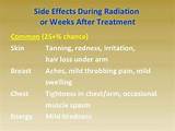 Radiation Therapy Side Effects Photos