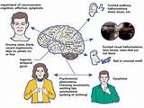 Clinical Seizures Symptoms Pictures