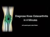 Photos of Osteoarthritis Knee Home Remedies