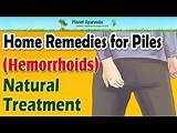 Home Remedies For Fissures And Hemorrhoids Pictures