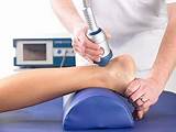 Pictures of Shockwave Therapy Achilles
