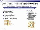Pictures of Exercises Spinal Stenosis