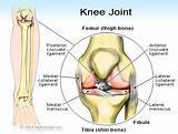 Pictures of When To See A Doctor For Knee Pain