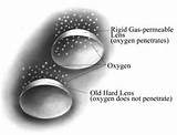 Photos of Gas Permeable Contact Lenses