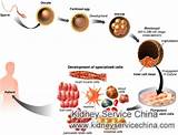 Stem Cell Therapy For Kidney Failure Photos
