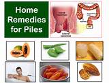 Images of Piles Home Remedies