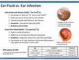 Pictures of Home Remedies For Otitis Media With Effusion
