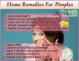 Pimple Spot Removal Home Remedies Pictures