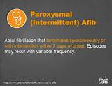 Paroxysmal Atrial Fibrillation Treatment Options Photos