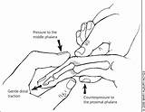 Images of Torn Tendon In Thumb Recovery Time