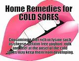 Cold Sore Prevention Medication Images