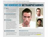 Crystal Meth Treatment Programs Pictures