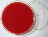 Blood Agar Plate Images