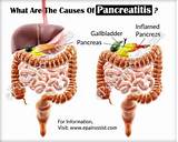 Photos of Pancreatitis Treatment Home Remedies