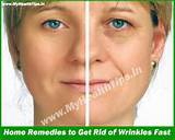 Images of Wrinkled Lips Home Remedies