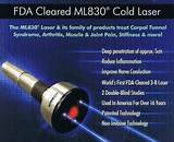 Laser Cold Therapy Pictures