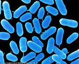 Photos of Where Can Listeria Be Found