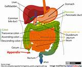 Appendix Cancer Treatment Images