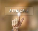 Stem Cell Therapy Hospital For Special Surgery Pictures