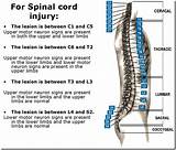 Images of Disease Of The Brain And Spinal Cord Medical Term