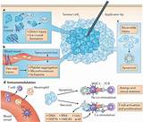 Photos of Ice Treatment For Cancer